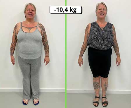 Avant/après perte de poids