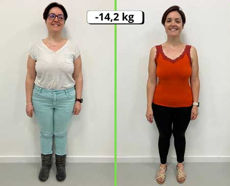 Résultat femme avant/après